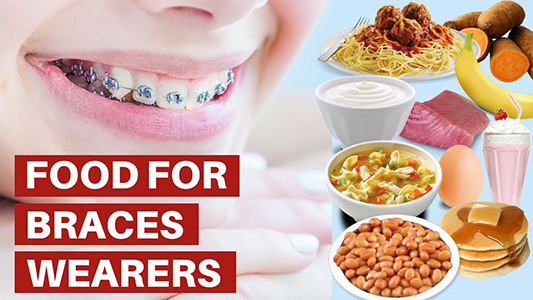 Can You Eat Fruit Snacks with Braces?